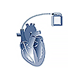 KARDIO-ICD – Registr implantabilních kardioverter-defibrilátorů (ICD)